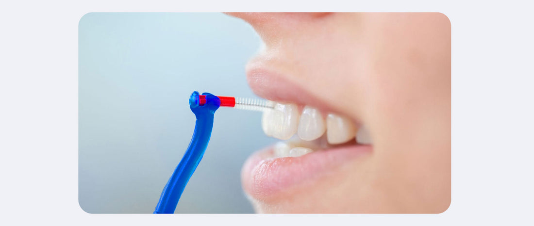 Blog : Brossette ou jet dentaire - monjetdentaire.fr