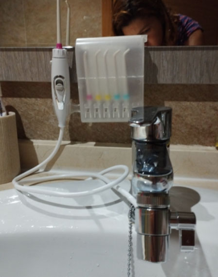 jet dentaire non électrique pour robinet - avis clients - monjetdentaire.fr